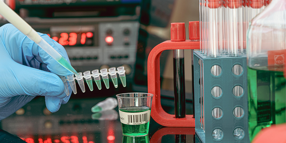 Close-up of a gloved hand using a micropipette to inject liquid into a vial for a chromatography test.