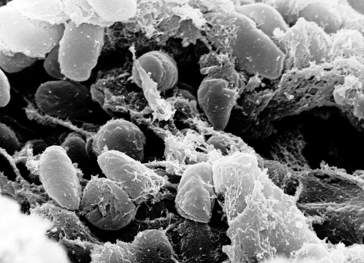 Yersina pestis